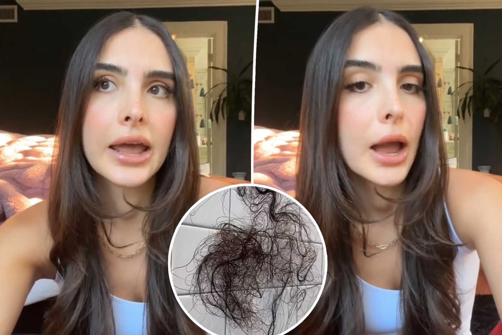 Sophia Umansky Mounjaro Hair Loss