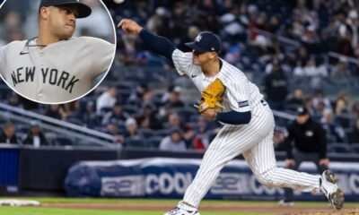 Yankees Bullpen Injury Fernando Cruz
