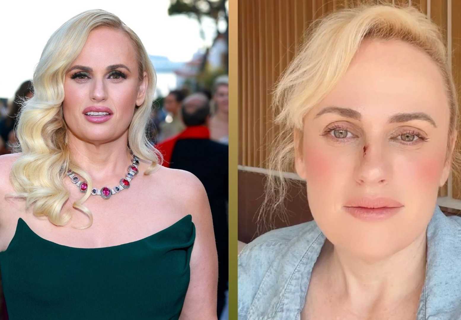 Rebel Wilson Action Comedy Film Set Injury