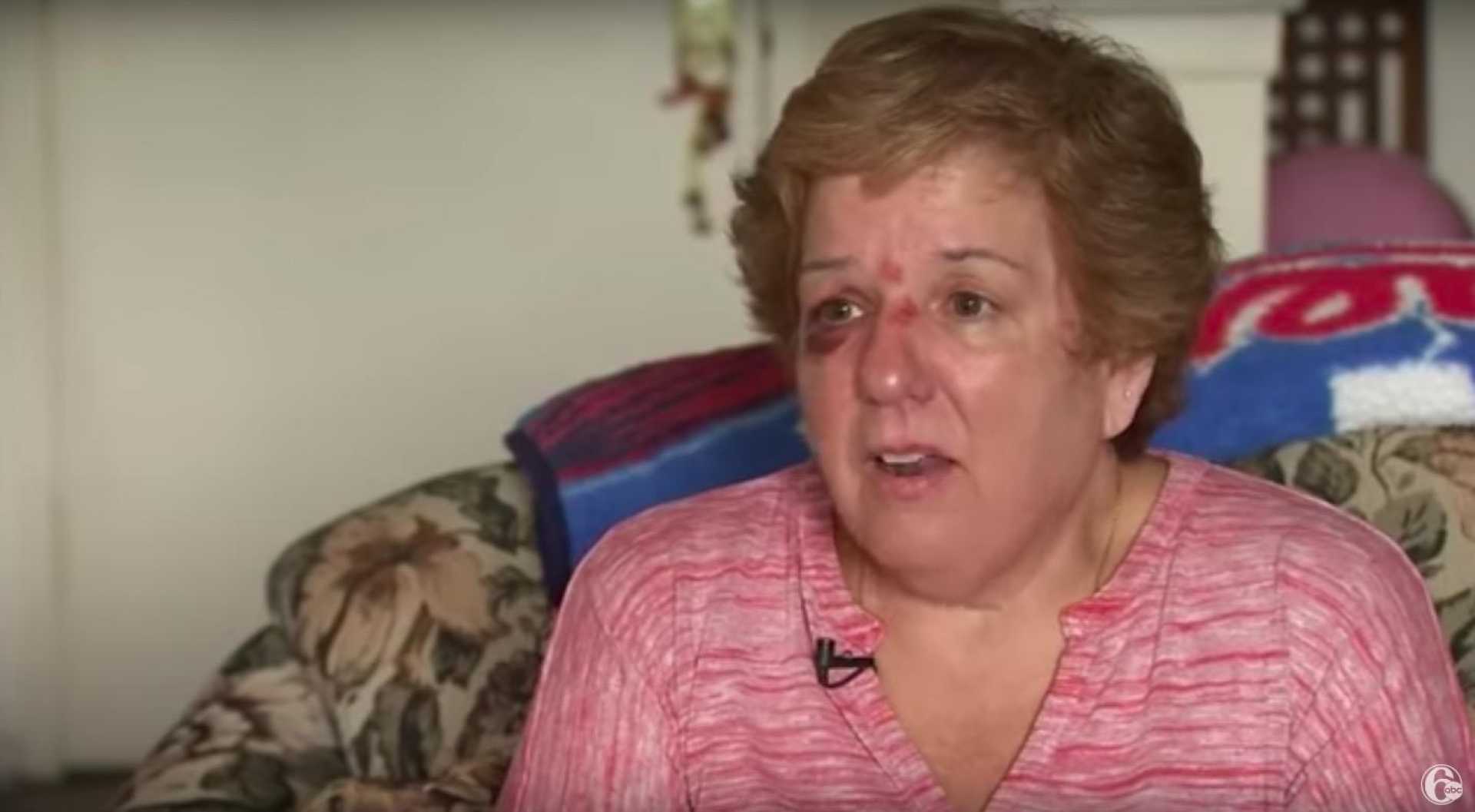 Woman Hit By Baseball Phillies Game