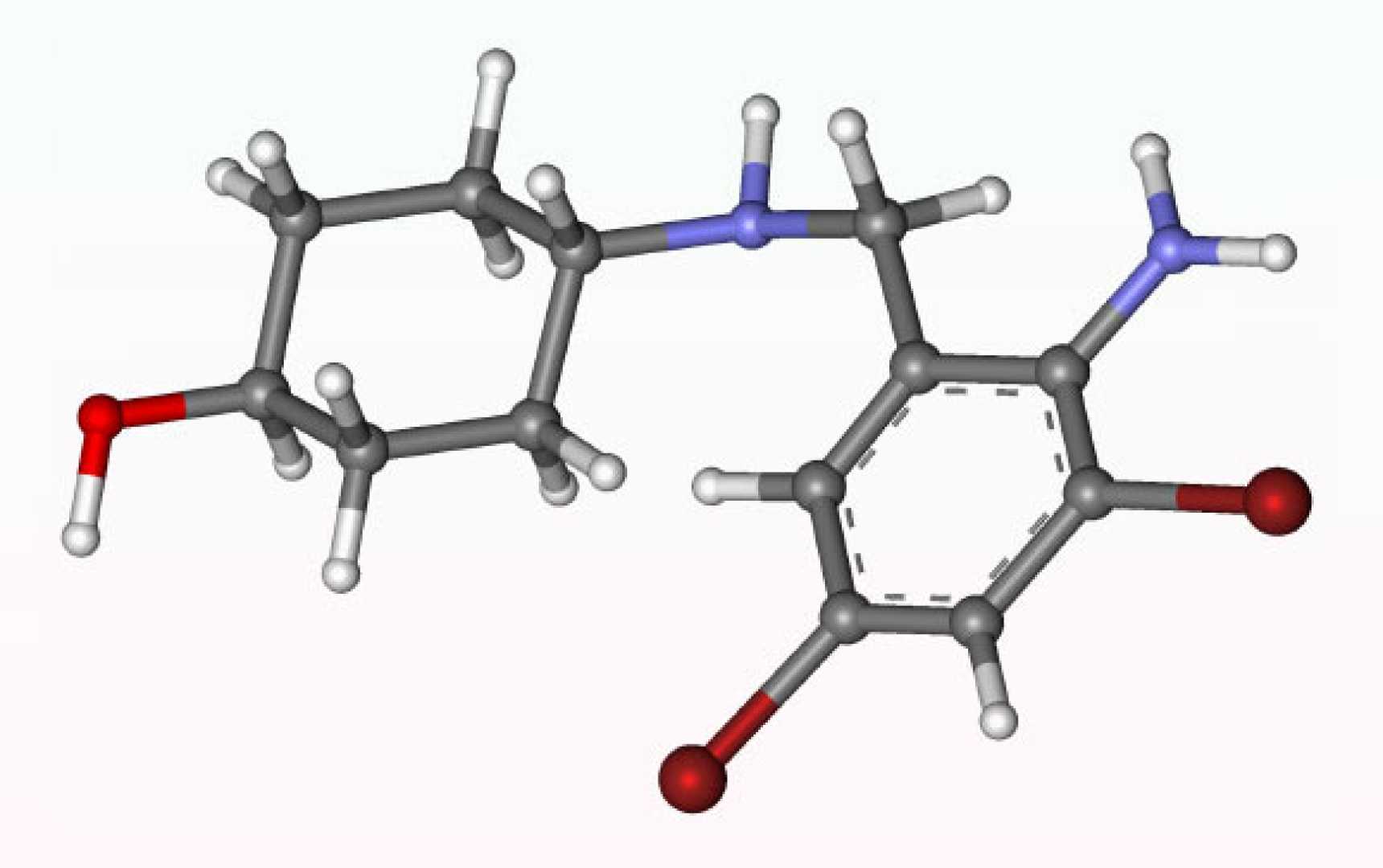 Ambroxol Parkinson's Dementia Clinical Trial