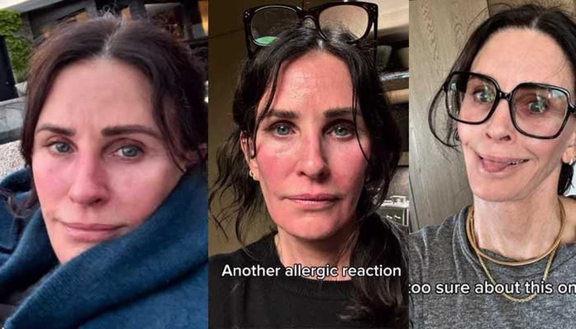 Courteney Cox Selfie Allergic Reaction