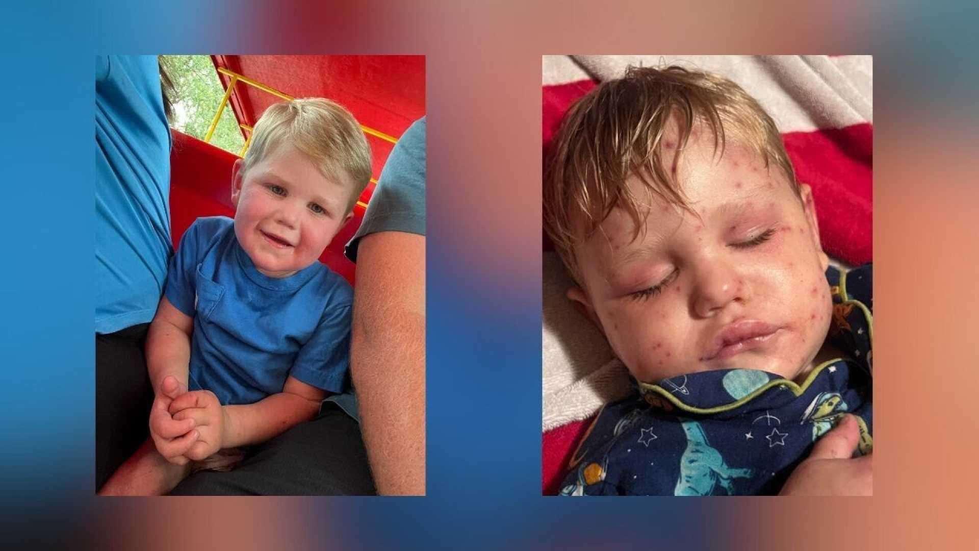 Georgia Boy Yellowjackets Sting
