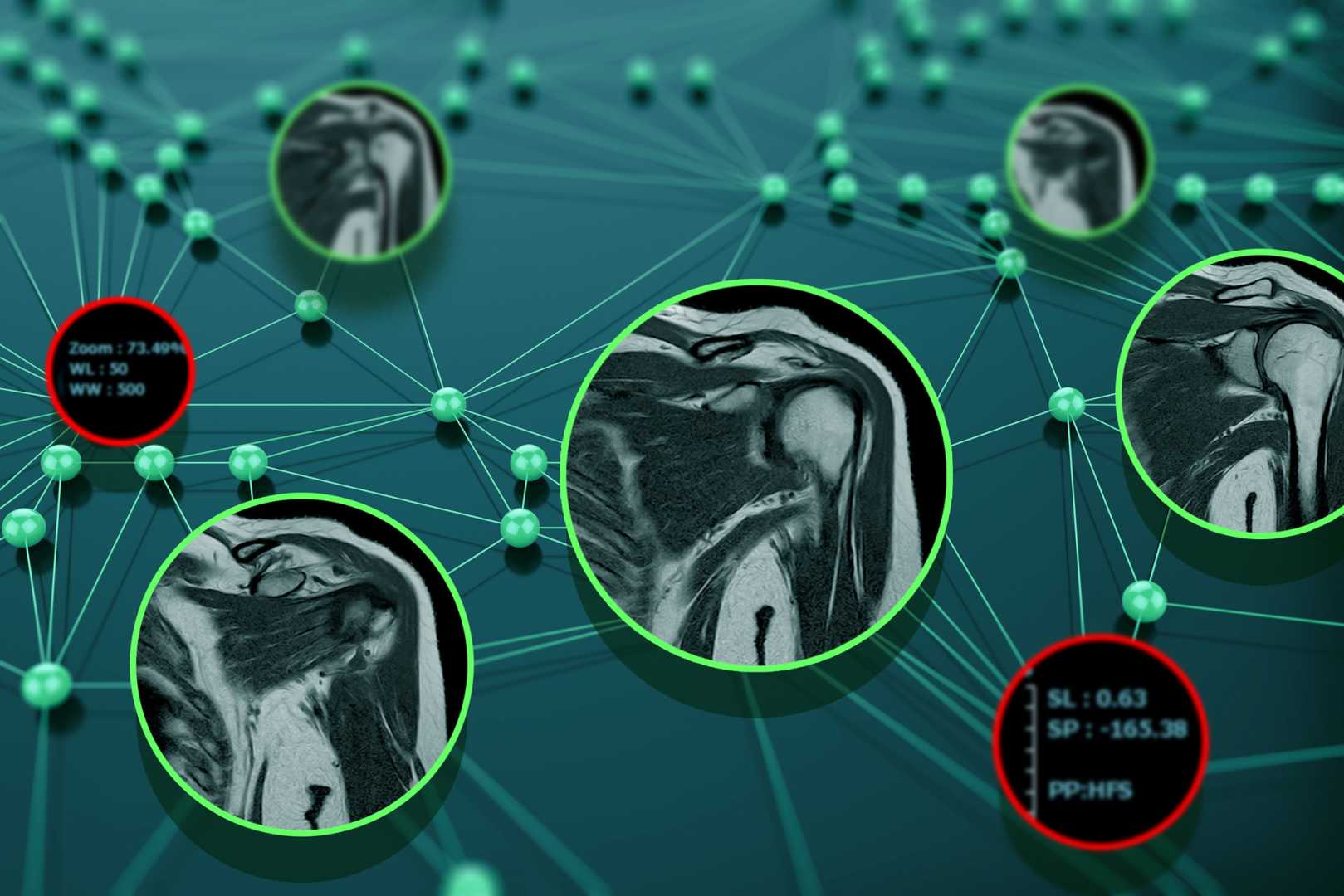Machine Learning Feature News