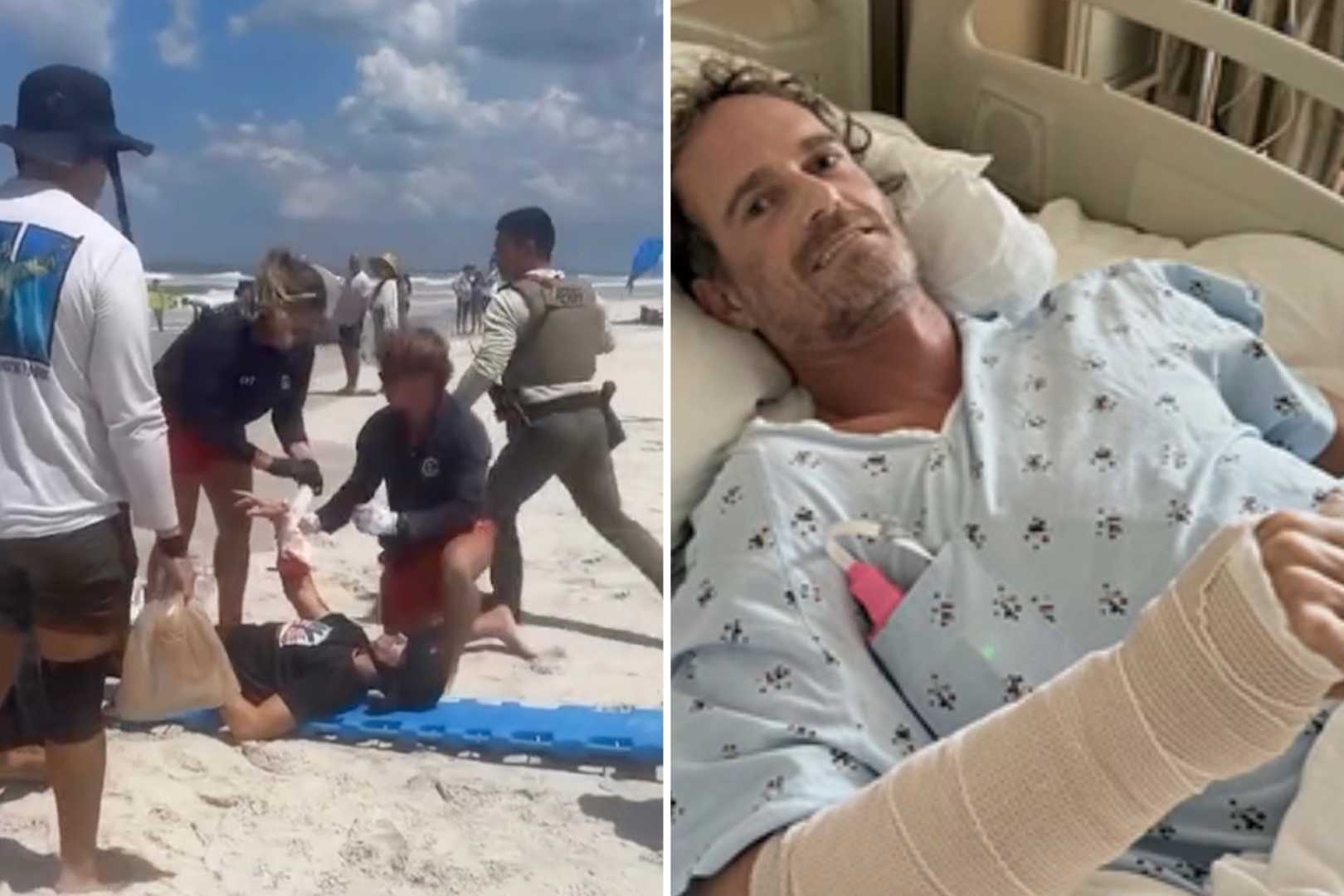 Matt Bender Shark Bite New Smyrna Beach