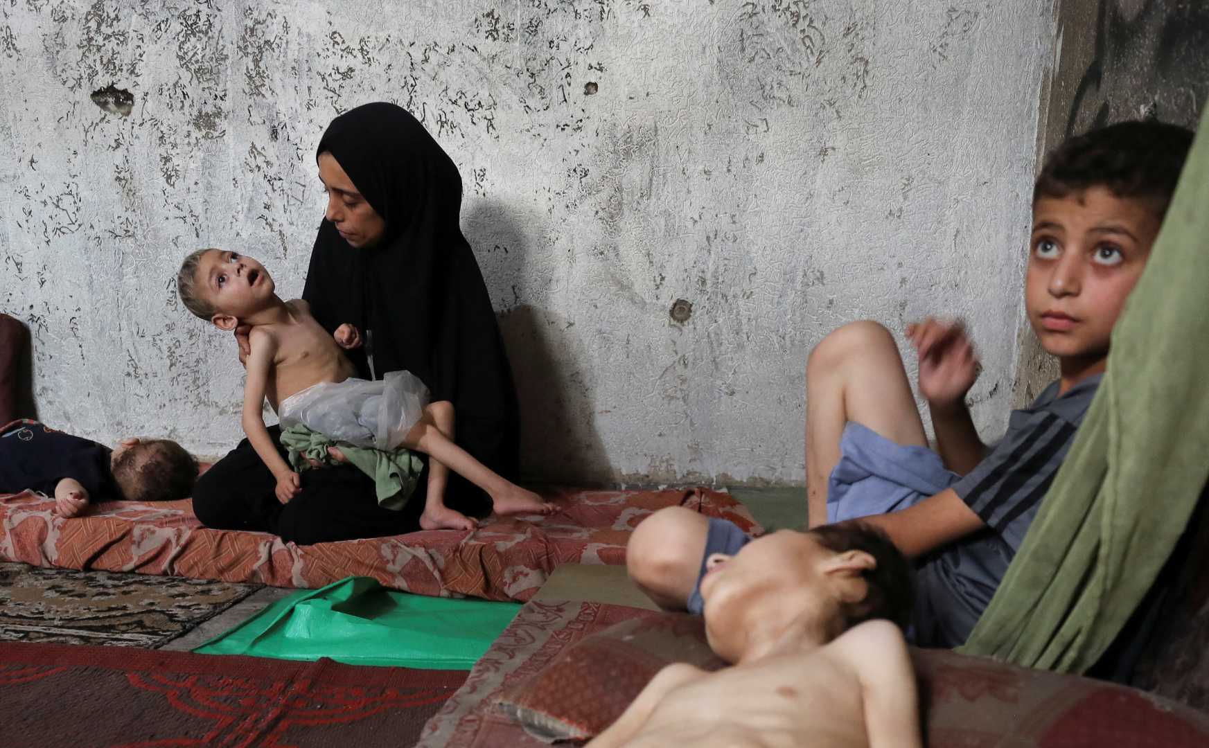 Palestinian Baby Malnutrition Death Gaza