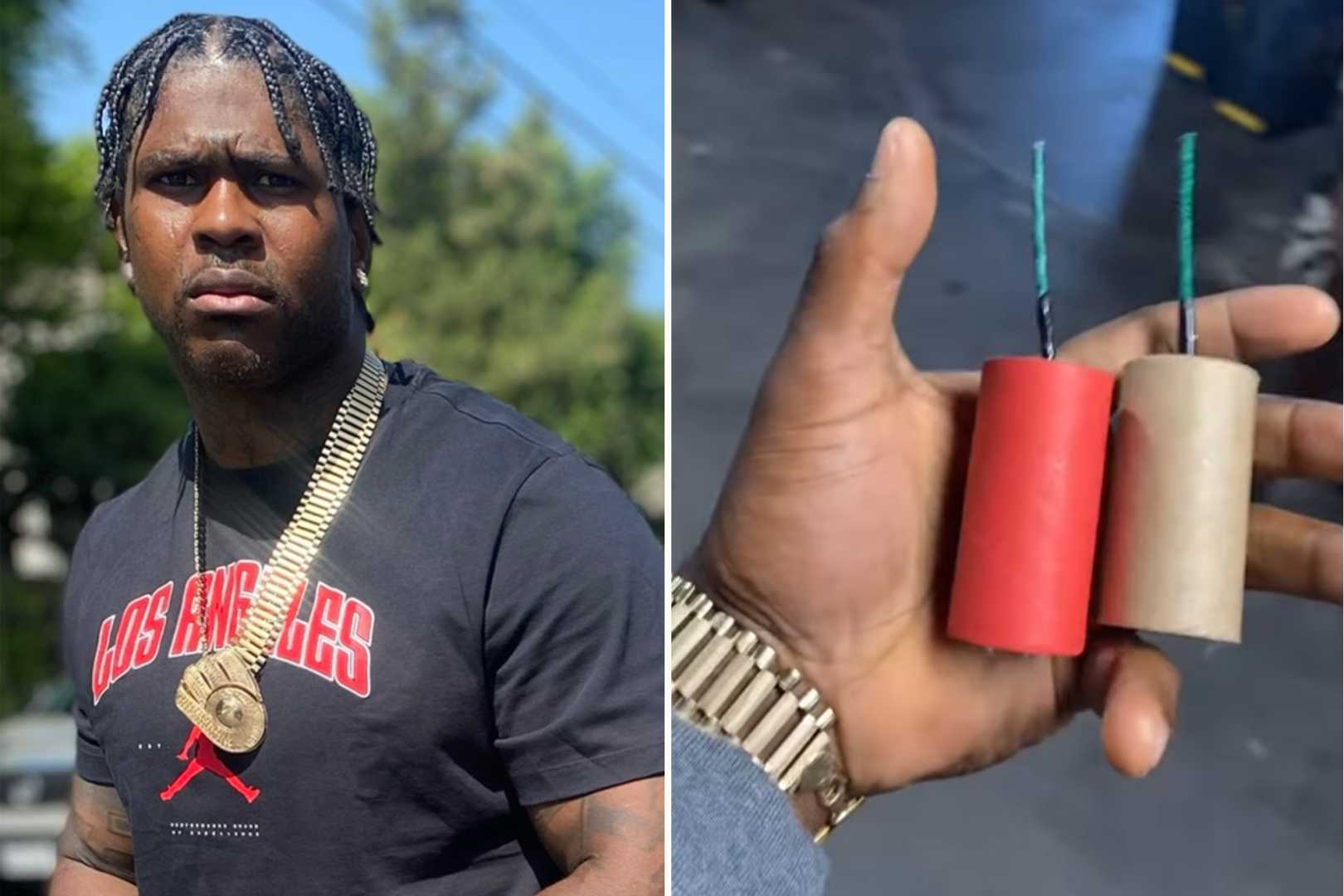 Rapper 4xtra Fireworks Injury