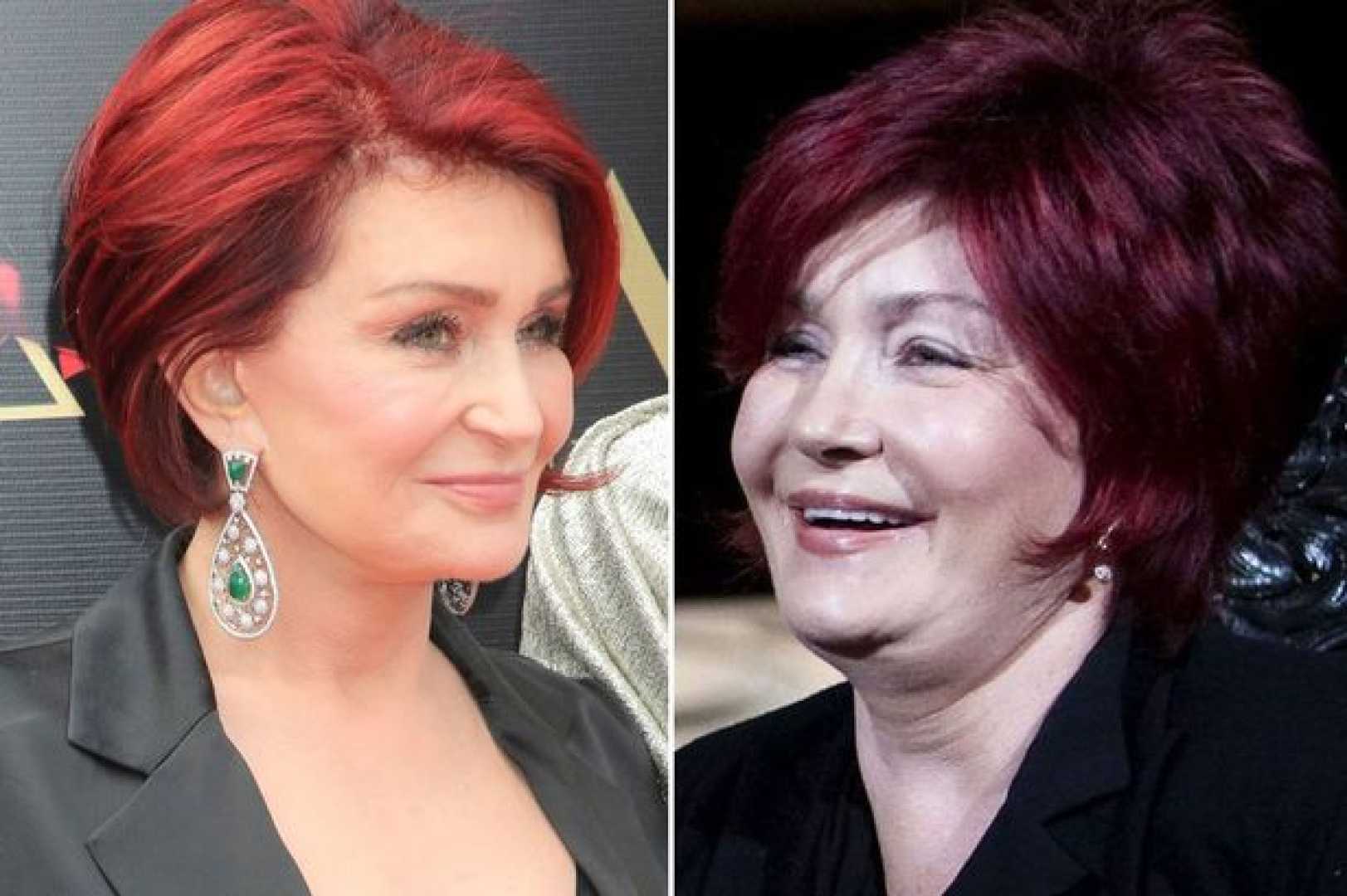 Sharon Osbourne Weight Loss Journey