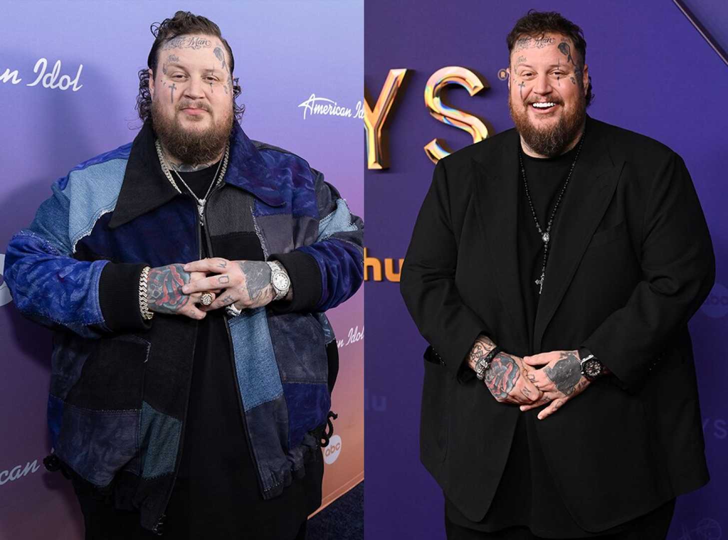 Jelly Roll Weight Loss Journey