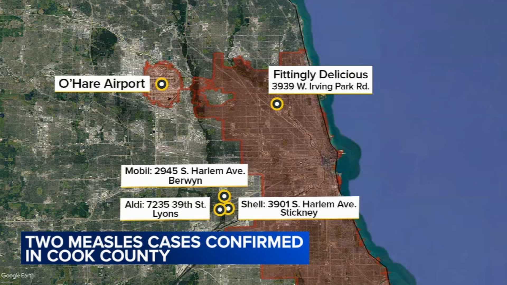 Measles Vaccination Concerns In Cook County