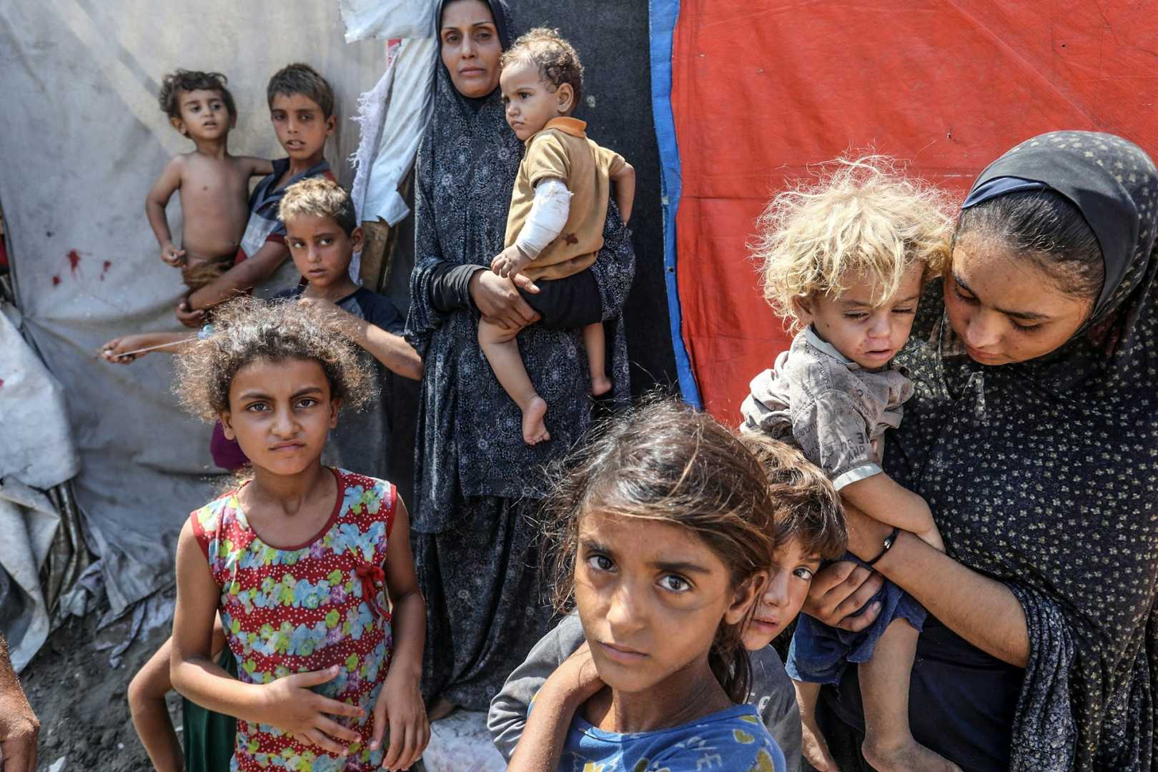 Gaza Famine Children Malnutrition Crisis