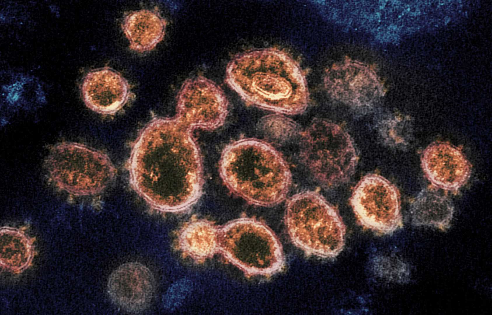 Ireland Covid Cases Spike Stratus Variant