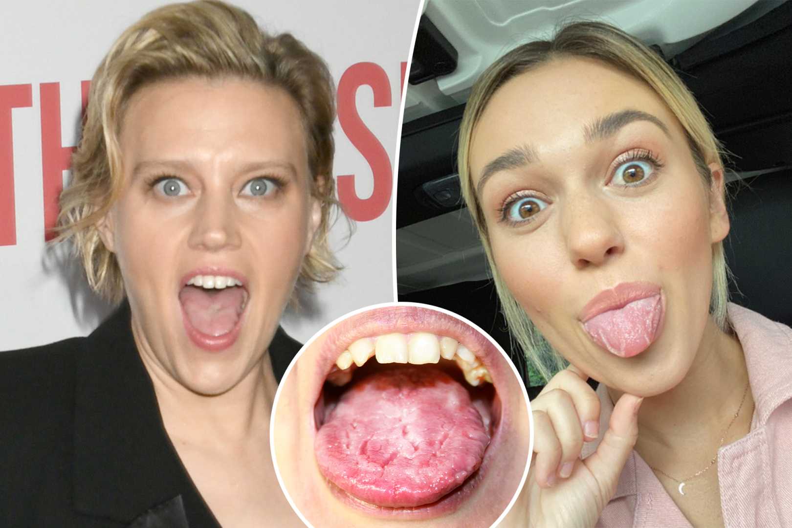 Kate Mckinnon Geographic Tongue