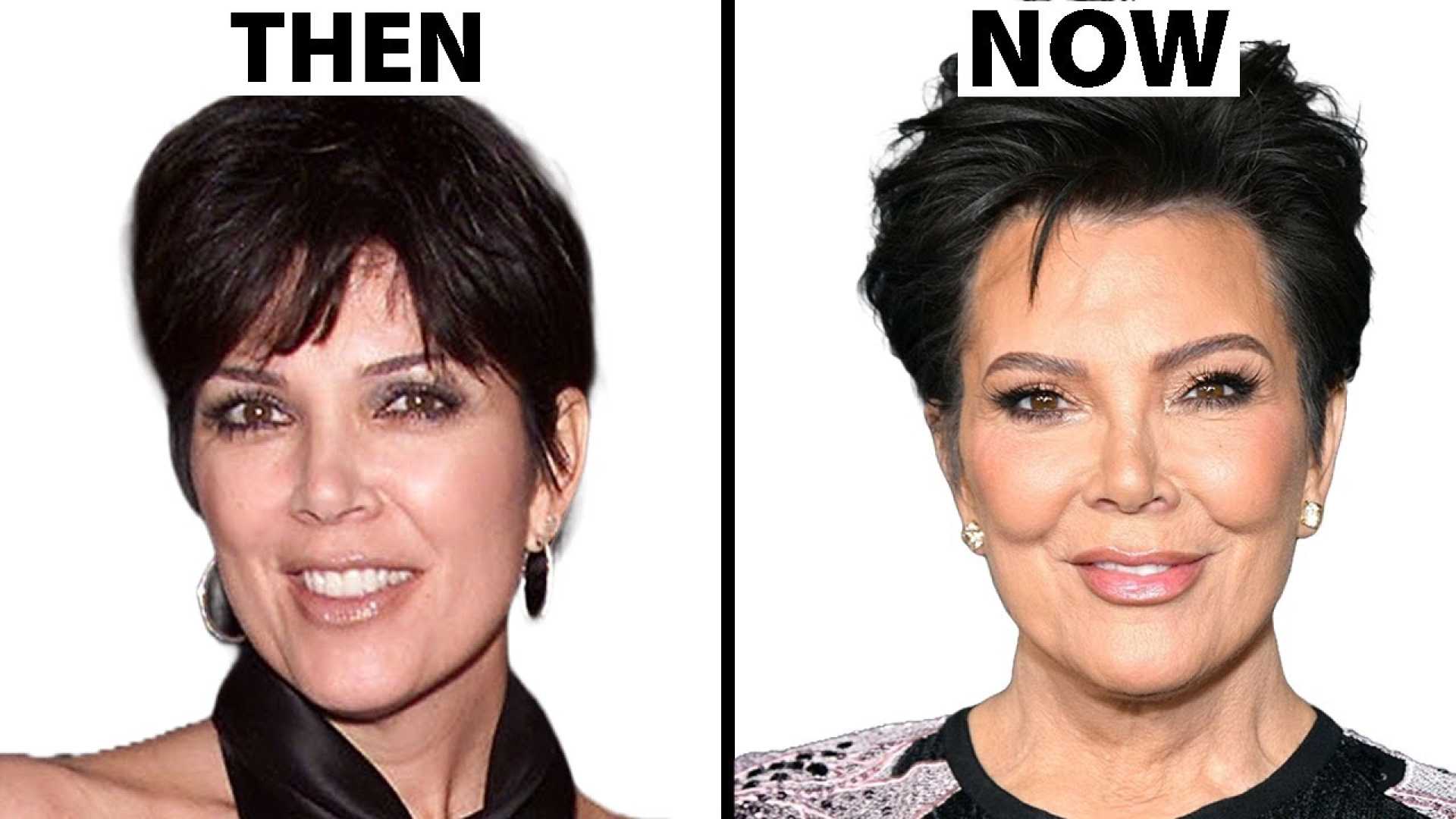 Kris Jenner Cosmetic Surgery News