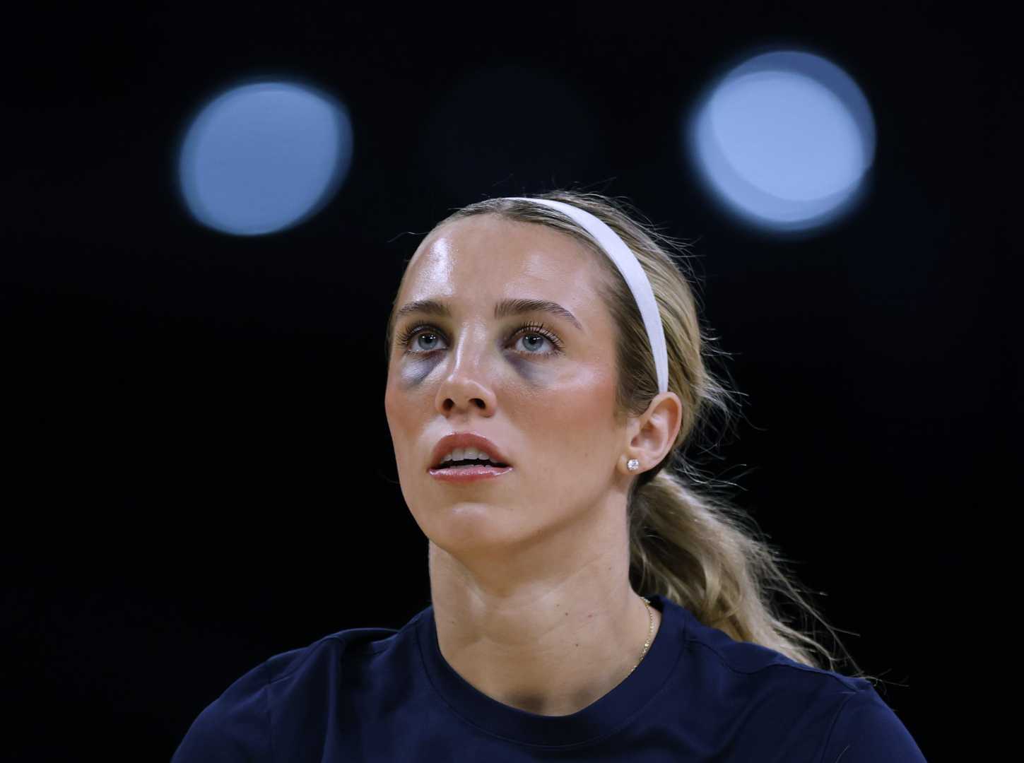 Lexie Hull Indiana Fever Injury News