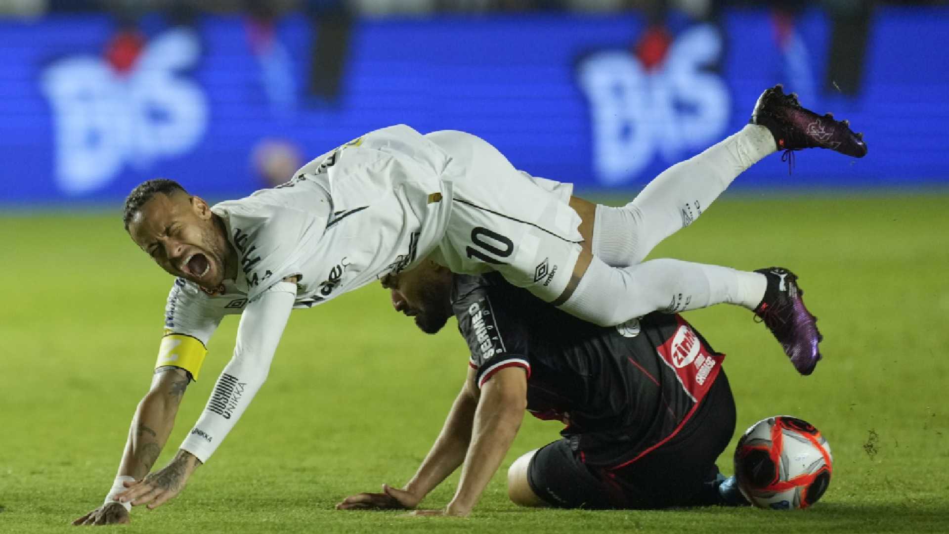 Botafogo Santos Match