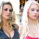 Courtney Stodden Plastic Surgery