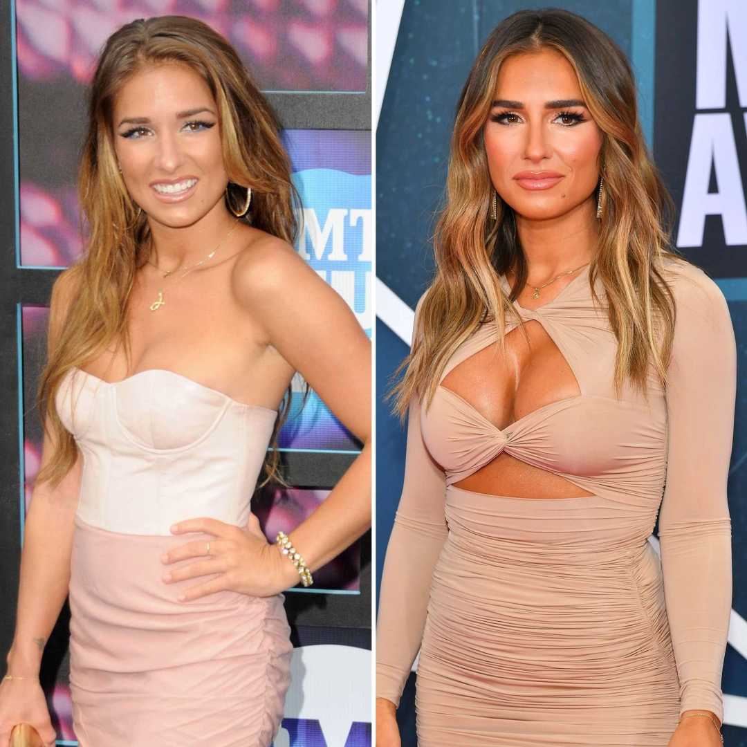 Jessie James Decker Plastic Surgery