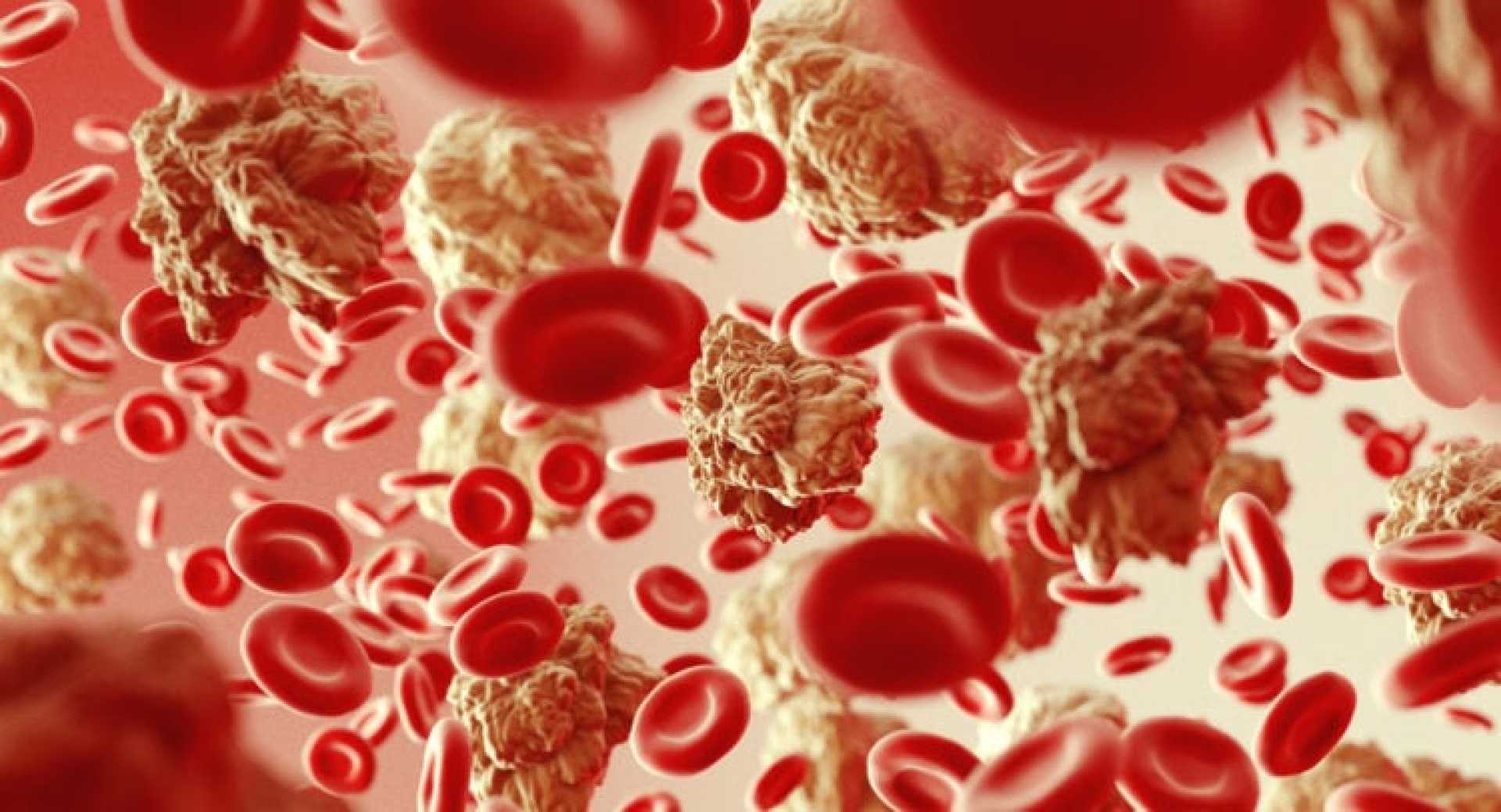 Galecto Damora Therapeutics Acquisition