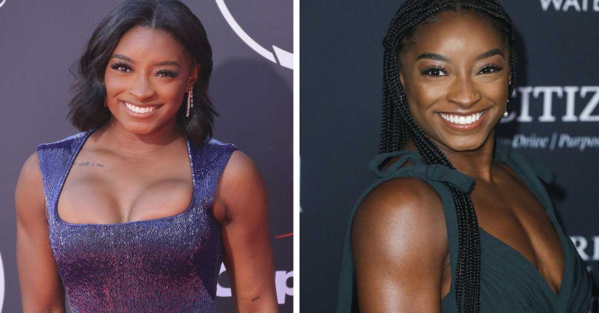 Simone Biles Plastic Surgery