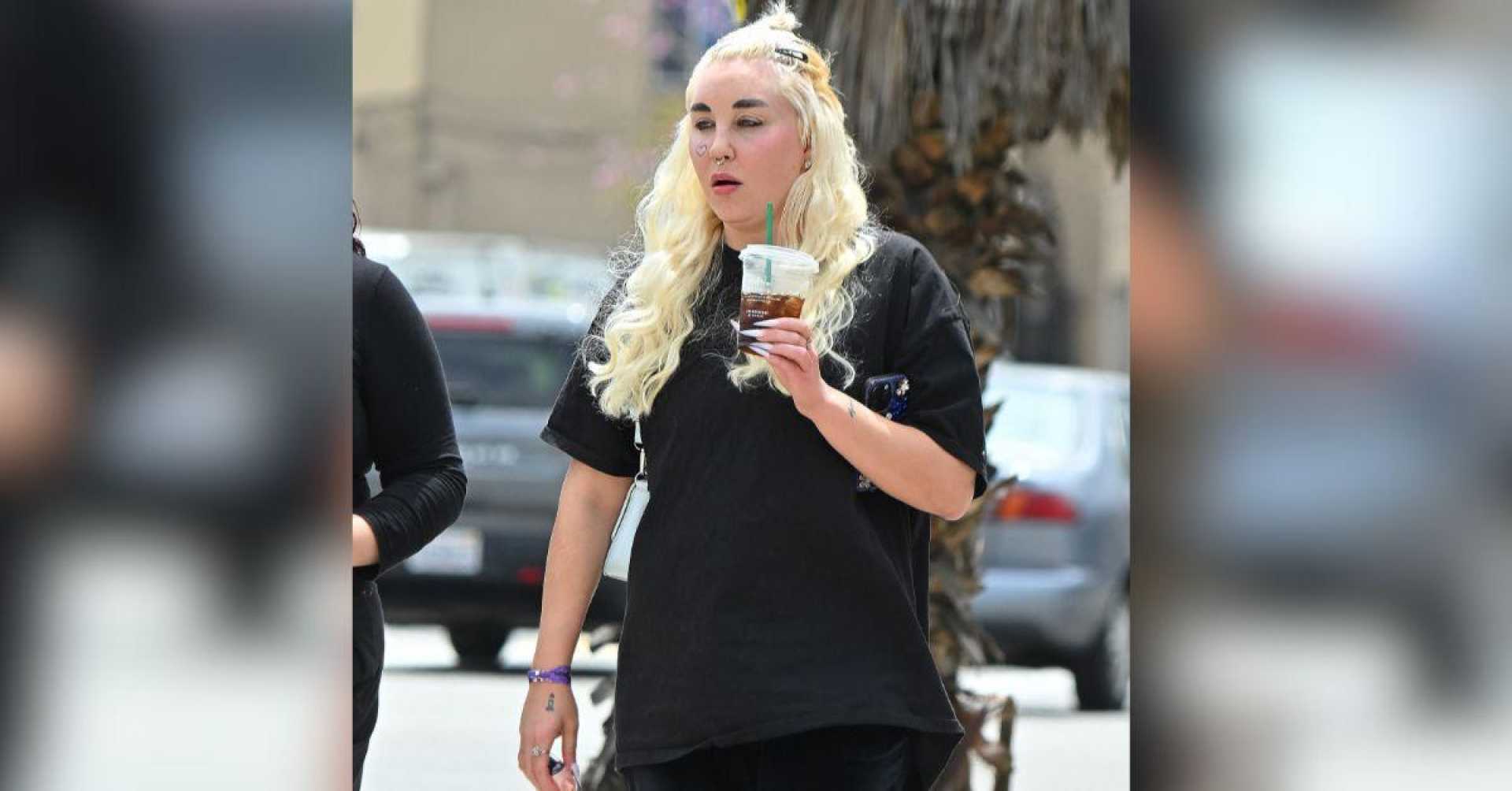 Amanda Bynes Weight Loss Ozempic