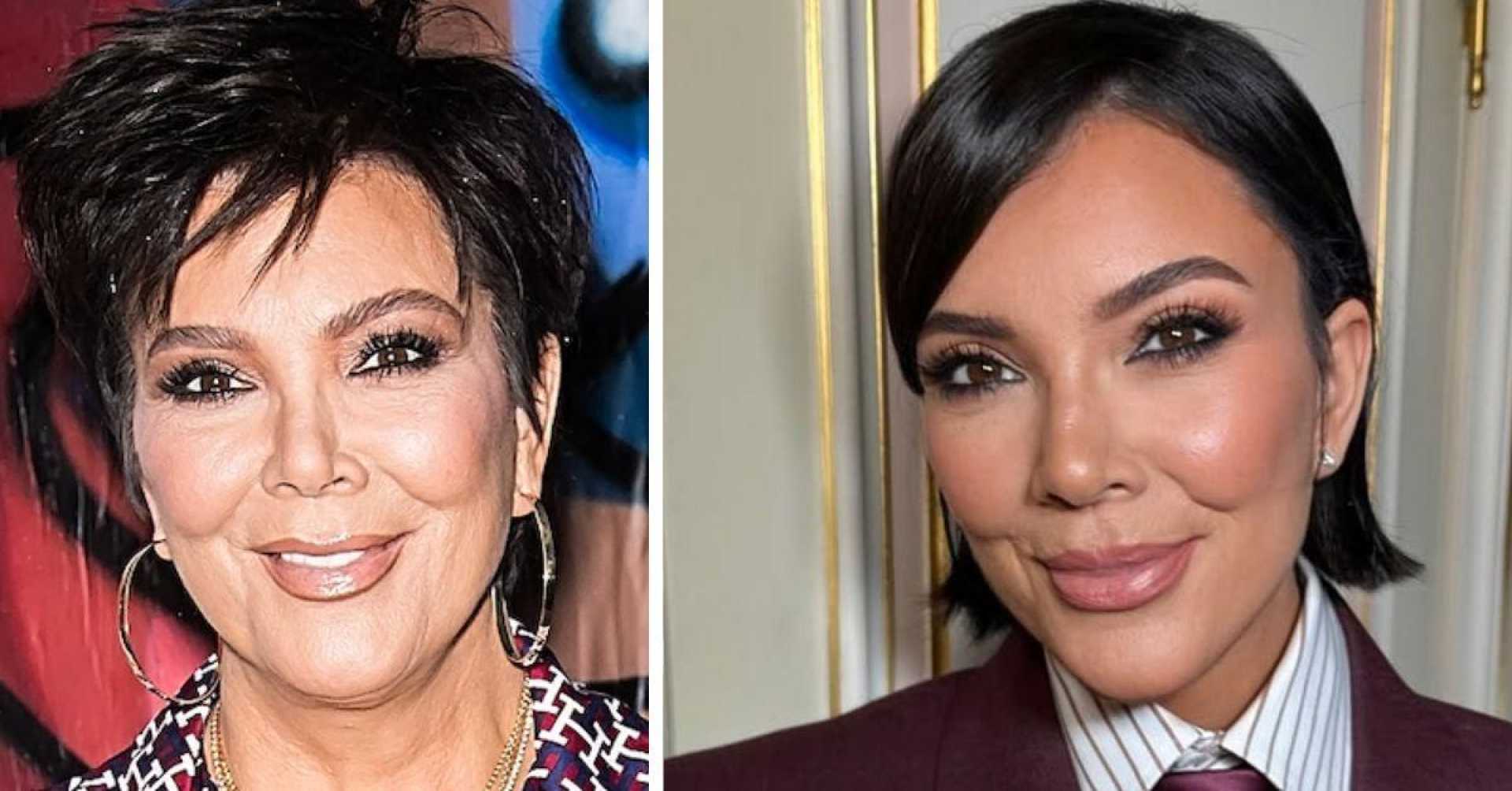 Kris Jenner Face Lift Hollywood 2025